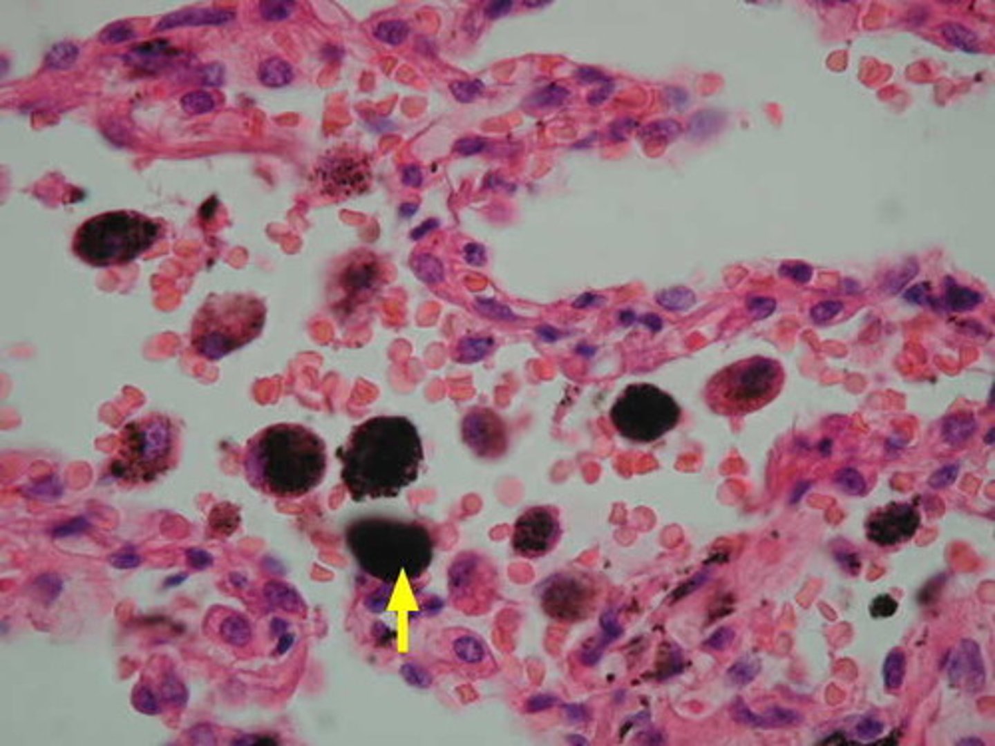 <p>Clean up bacteria and other debris</p><p>- cuboidal cells that secrete surfactant</p>