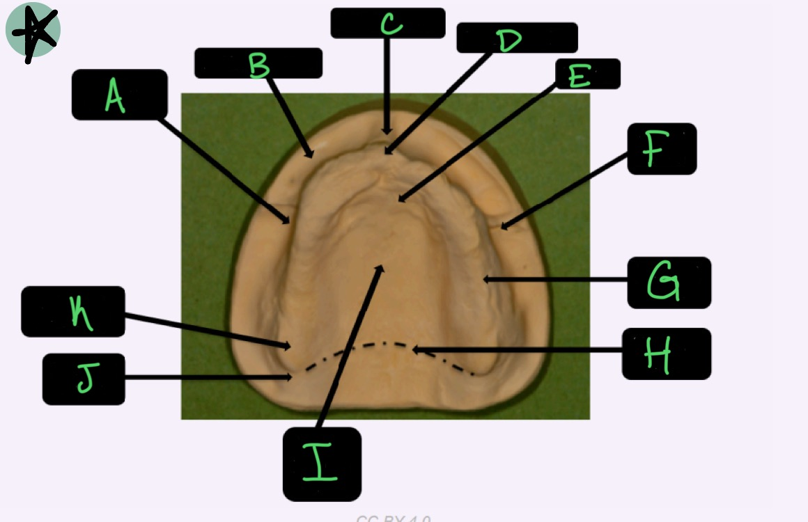 <p>What structure is labeled G?</p>