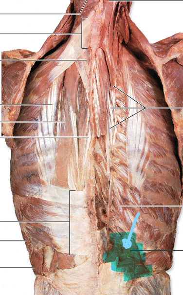 <p>Quadratus Lumborum</p>