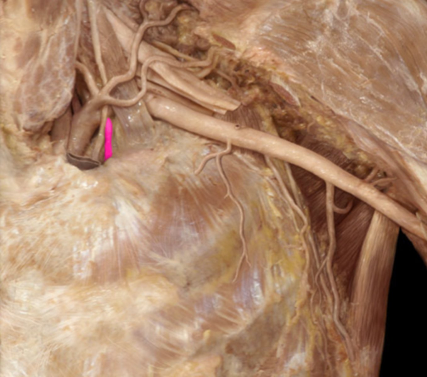 <p>comes off the l. subclavian, going towards the thorax</p>