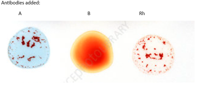 <p><span><span>What is the person's blood type?</span></span></p>