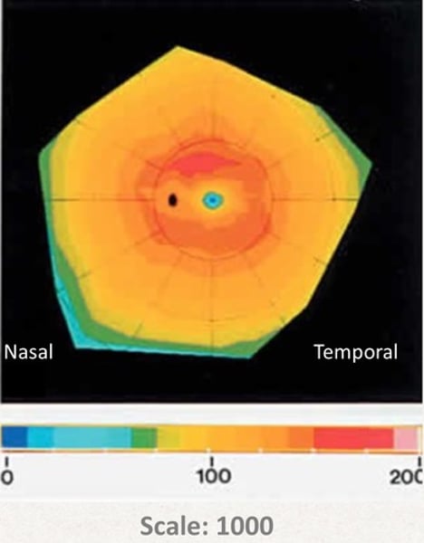 <p>pattern of rod and cone distribution around the fovea, showing that the greatest concentration of both is surrounding the optic disc (except for the optic disc itself) and the distribution decreases moving toward the periphery</p>