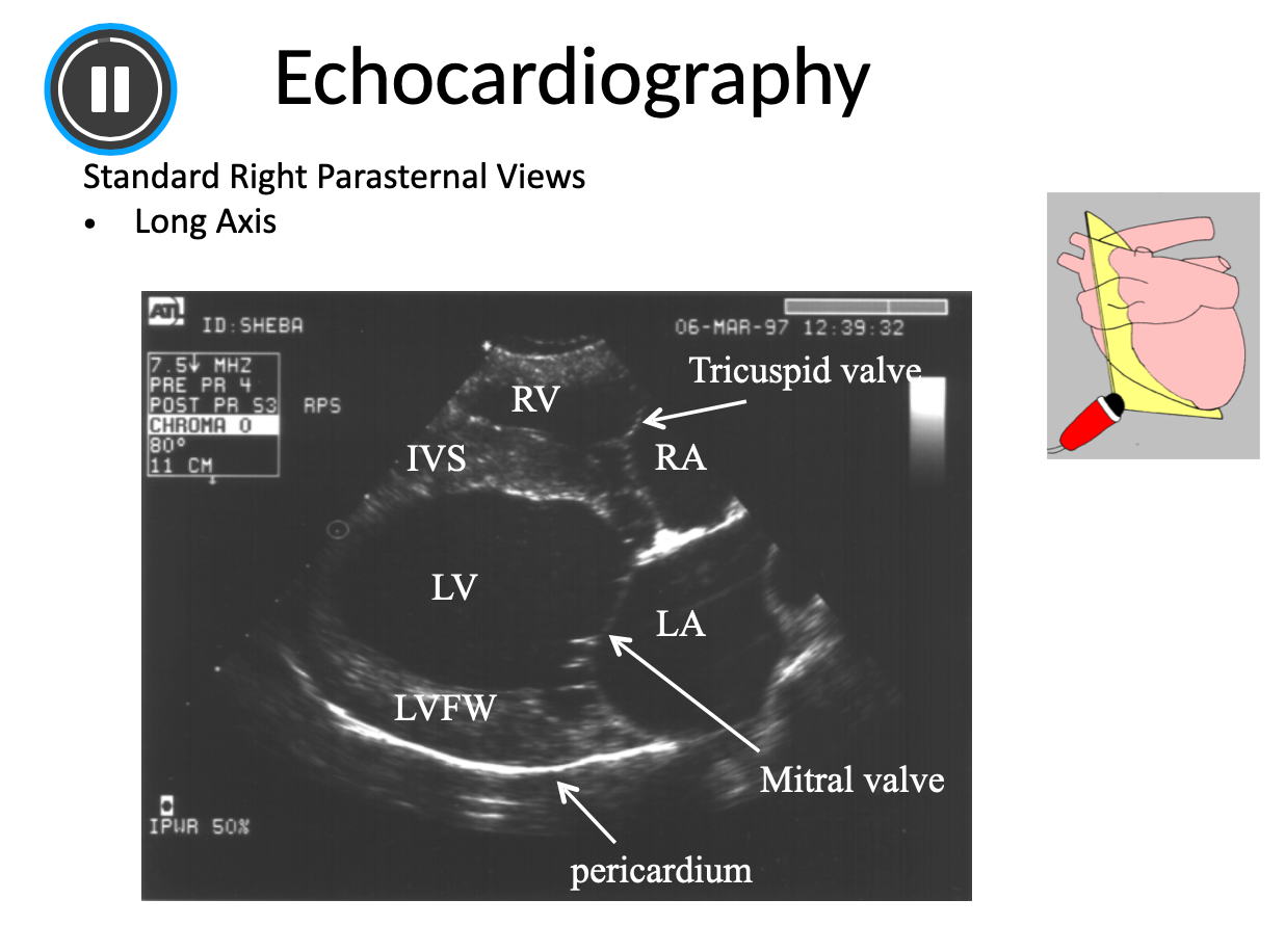 <p>Transducer rotated 90 degrees, parallel to long axis and at right angle with IC space</p><ul><li><p>Views displayed with base to right, and apex to the left</p></li><li><p>Pericardium appears hyper echoic - adhered to outside of heart</p></li></ul><p></p>