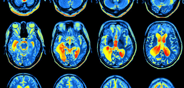 <p>Provides a visual representation of a patient’s physiological arousal using EMG, EEG, HRV, and/or GSR</p>