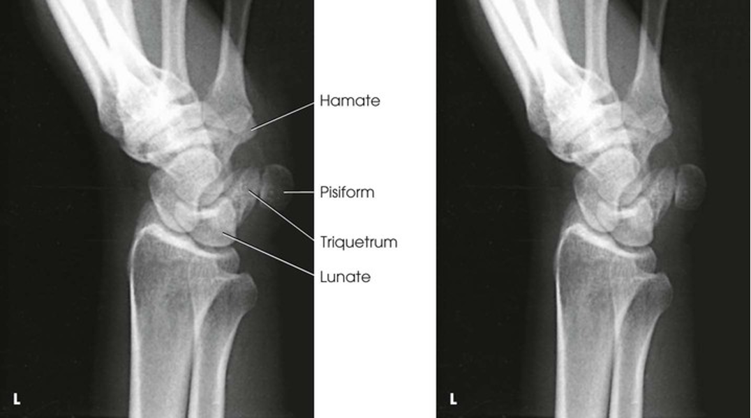 term image