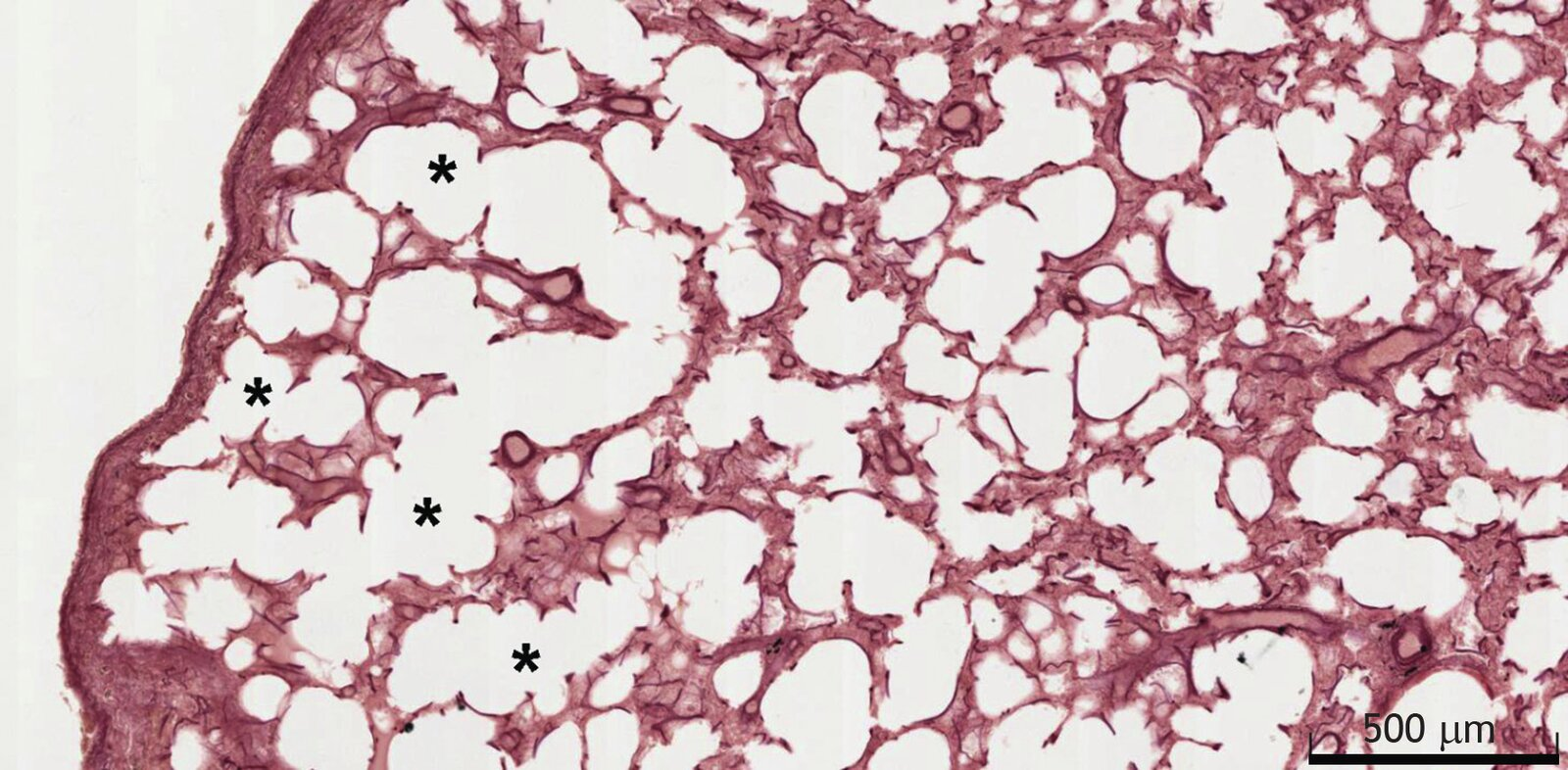 <p>33. The image shows a low‑magnification overview of the lung stained with Resorcin‑Fuchsin (highlighting elastic fibres). The regions of tissue marked by a star each have which of the following features?</p><p>A. Ciliated epithelial cells (ciliated epithelium)</p><p>B. Organ‑specific macrophages</p><p>C. Striated skeletal muscle</p><p>D. Fenestrated endothelium</p><p>E. Ito cells (hepatic stellate‑type cells)</p>