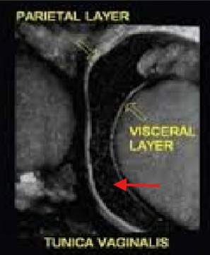 <p>What is the name for this space indicated by the red arrow?</p>