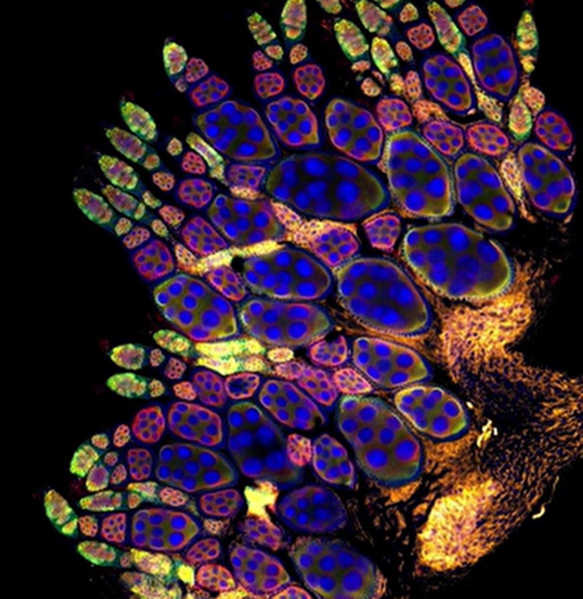 <p>fruit fly ovary</p>