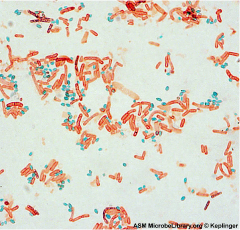 <p>Type of staining procedure in the picture</p>