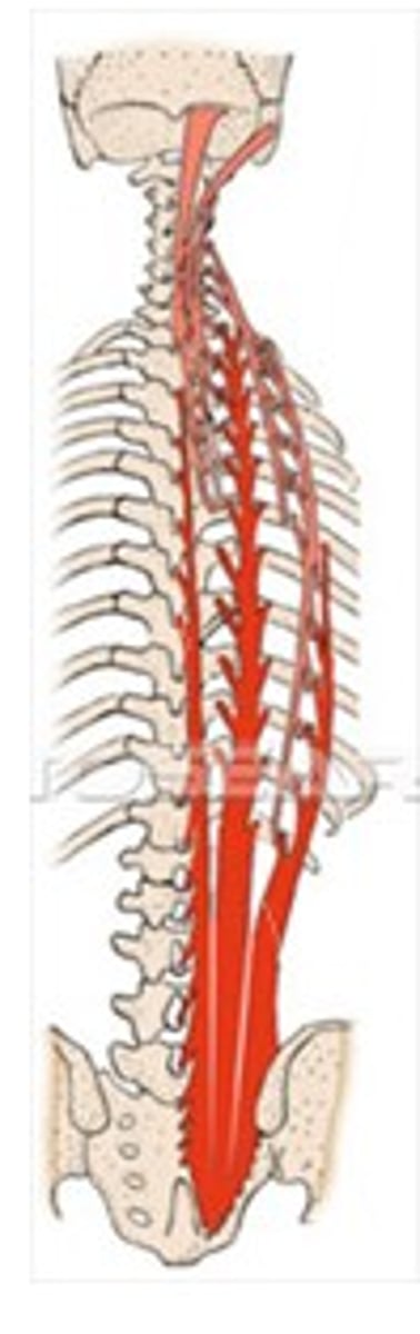 <p>what are the three erector spinae muscles from medial to lateral?</p>