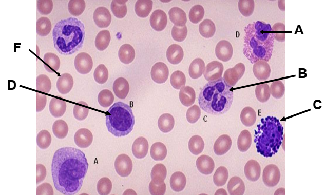 <p>ARROW LABELLED “C” IS POINTING </p>
