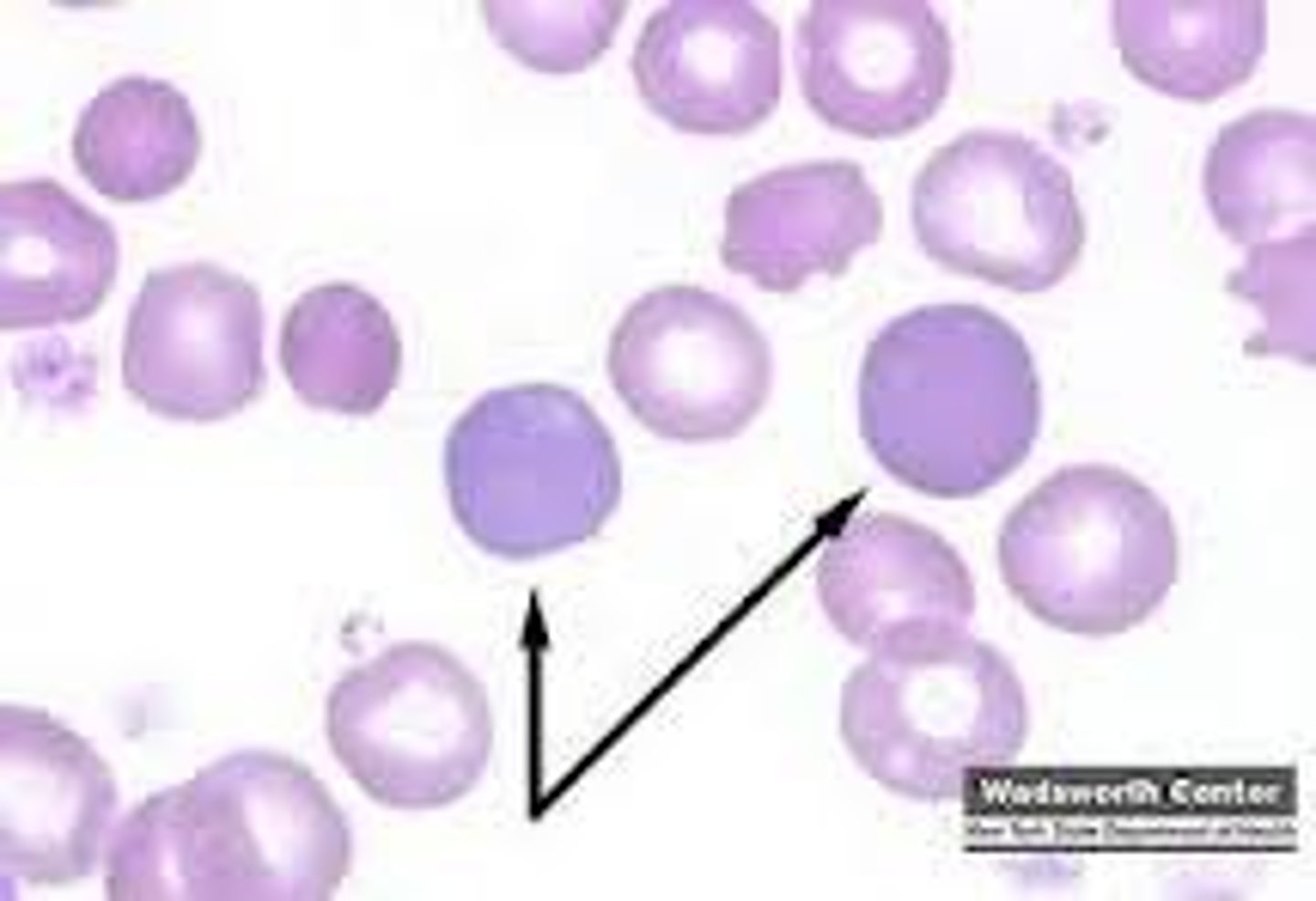 <p>polychromatophil</p>