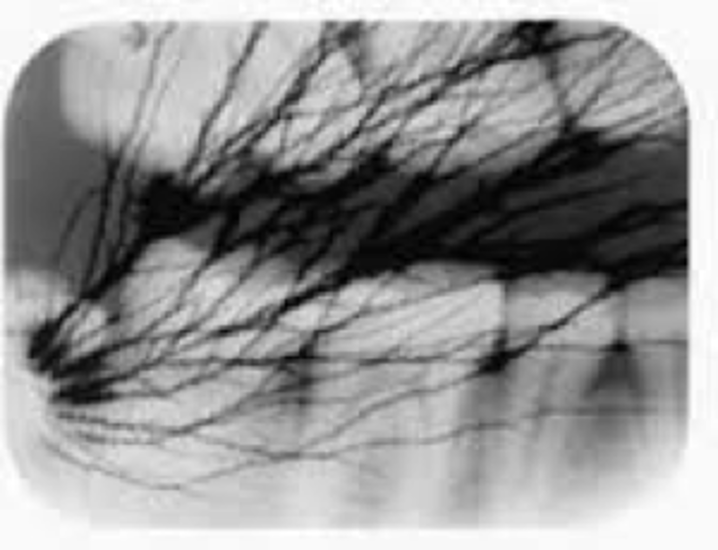 <p>-When the film is pulled out of the packet wrapping too fast.</p><p>-Static electricity creates a white light spark that exposes (blackens) the film</p>