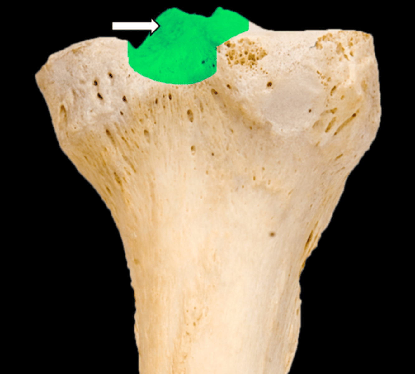 <p>name the part</p>