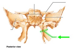 <p>Process of the sphenoid bone, consisting of two plates</p>