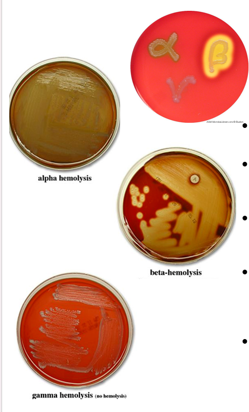 <p><span><strong><span>Blood Agar</span></strong></span></p>