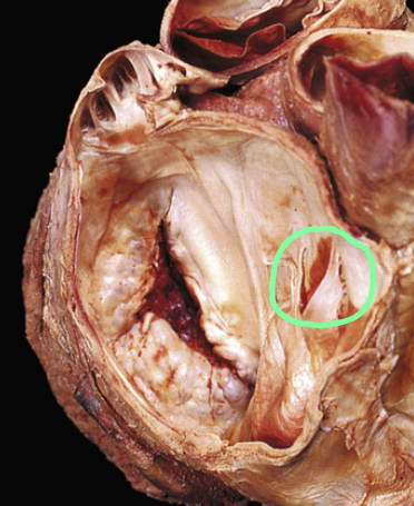 <p>What is circled?</p>