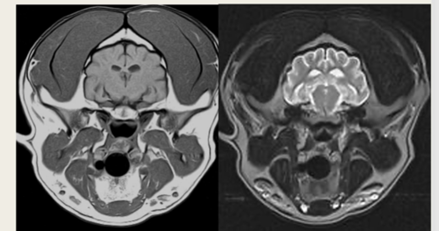 <p>which image is T1 weighted and which is T2 weighted?</p>