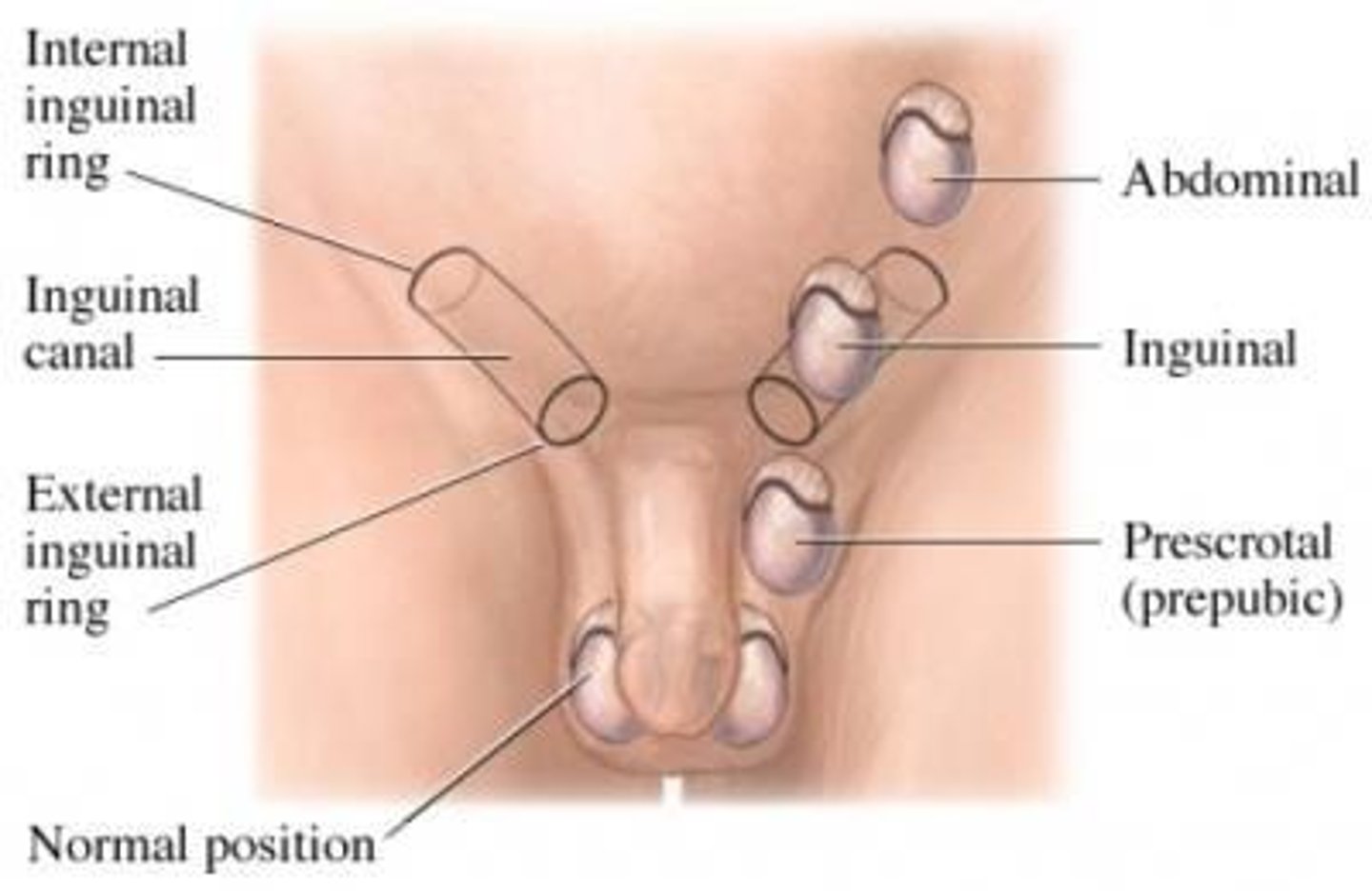 <p>A surgical procedure for male sterilization where the two vas deferens are cut and tied or sealed.</p>