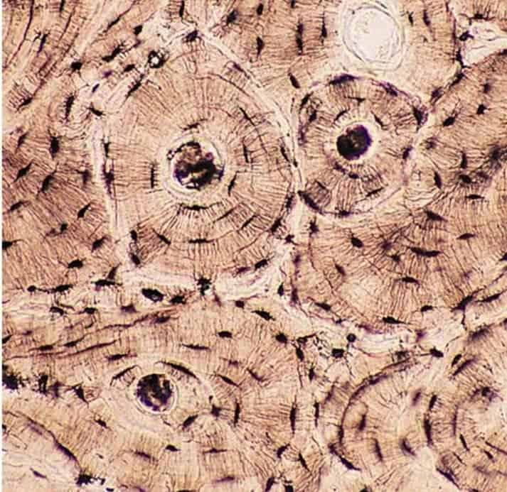 <p><span style="color: rgb(43, 49, 80)">A tissue sample studied under a microscope exhibits the following characteristics: an extracellular matrix providing rigidity to the tissue, and the presence of lacunae. Which type of tissue is this?</span></p>