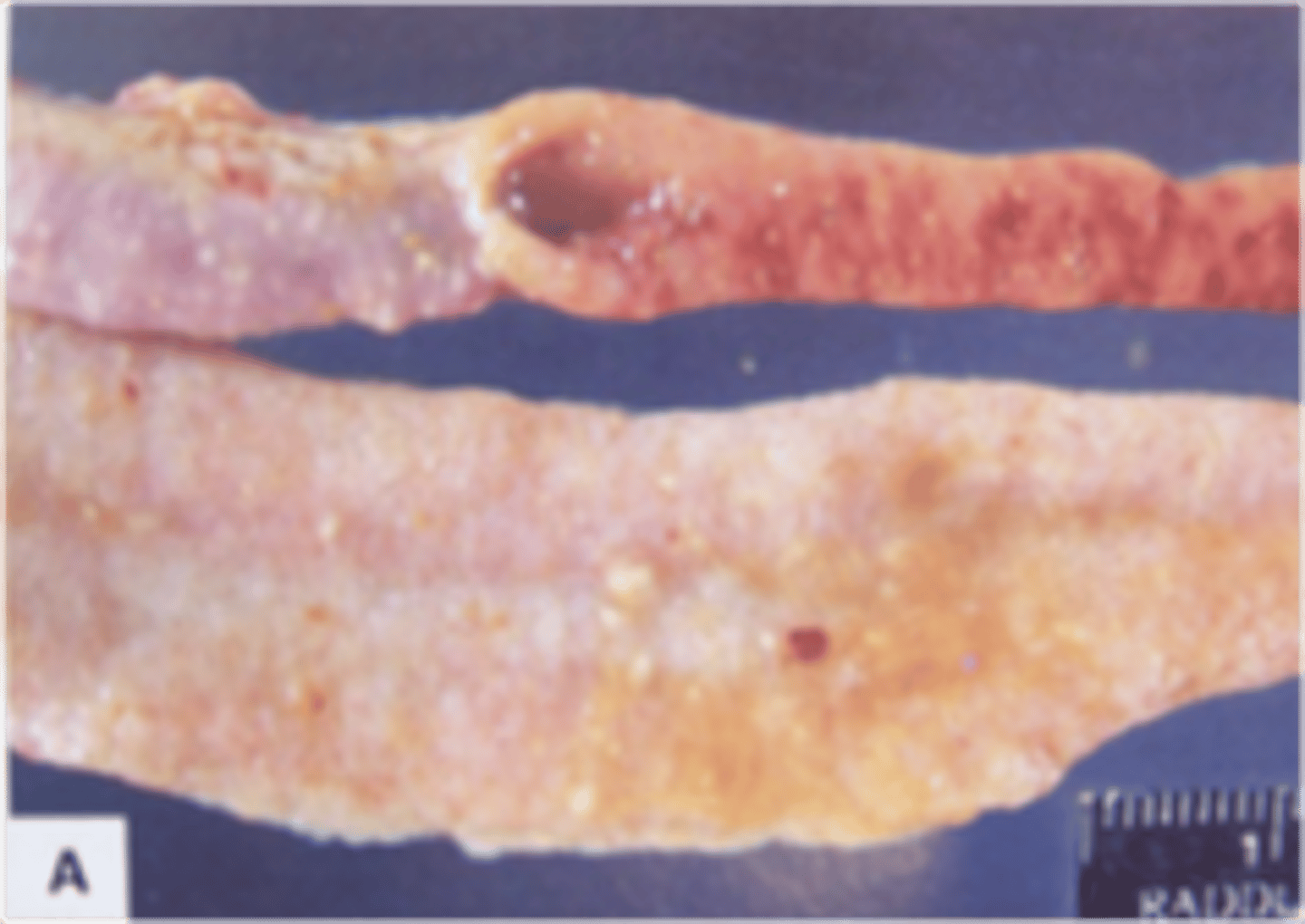 <p>the disease state in this pig is associated with what pathogen</p>