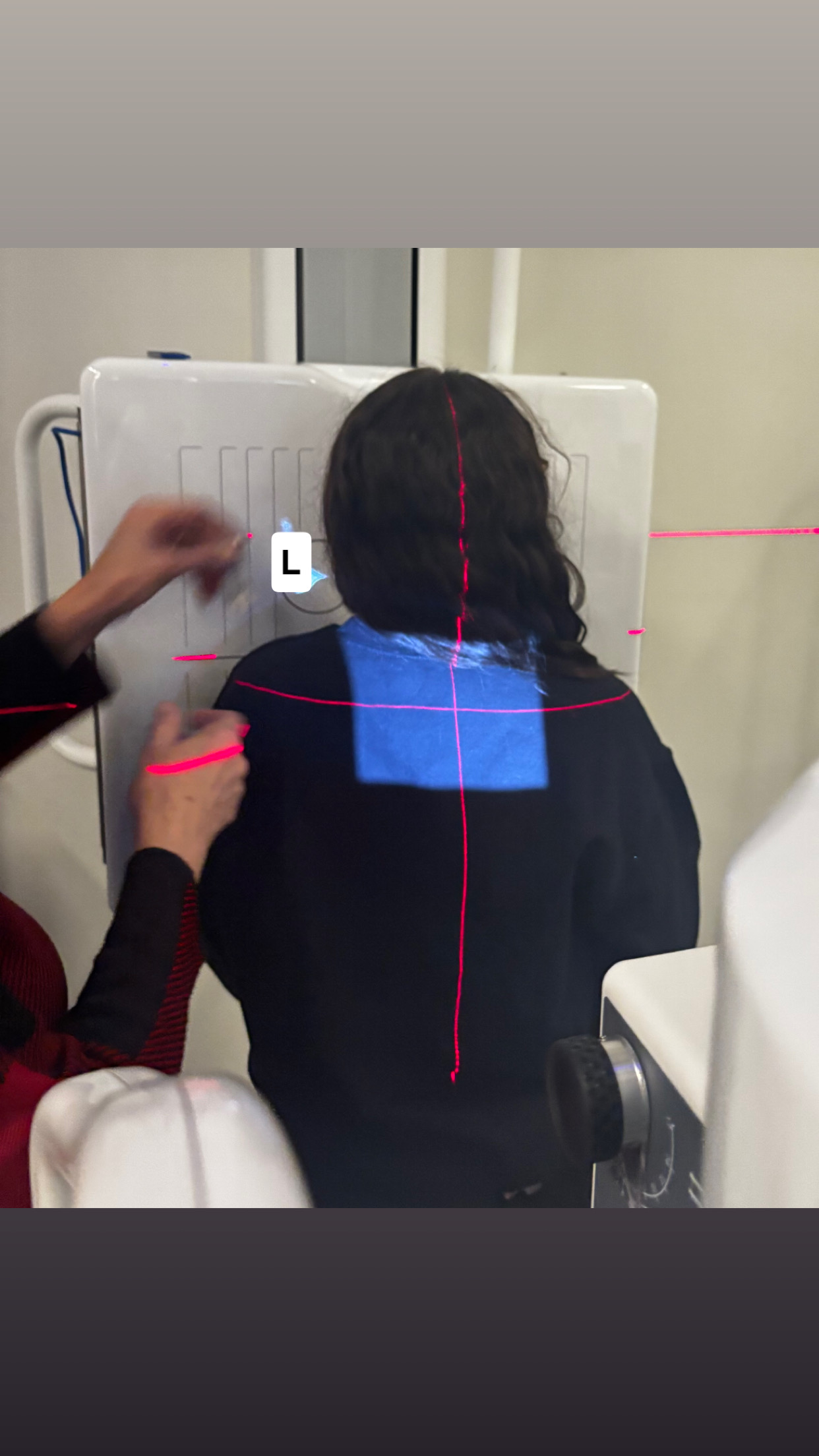 <p>SC joints- LAO</p>