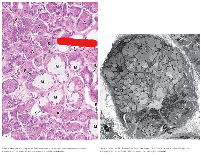<p>Which gland is this? Is it a serous, mucous, or mixed gland? What are some significant structures present?</p>