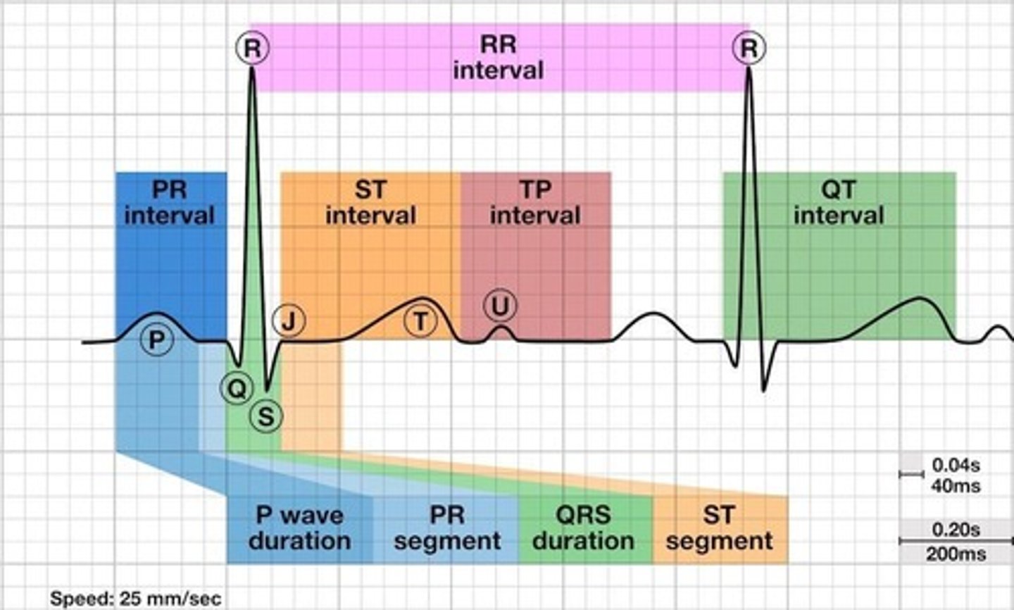 <p>A tracing of the electrical impulse of the heart.</p>
