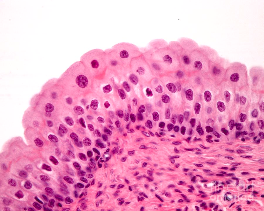 <p>Where are transitional epithelium tissues located?</p>