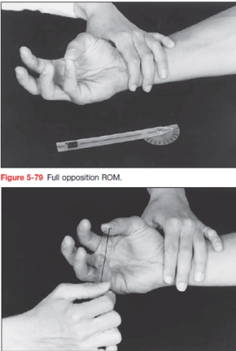 <p>a páciens képes összeérinteni a hüvelyk és a kisujj ujjbegyeinek hegyét (A mozgástartománybeli elmaradás vonalzóval mérhető a két ujjbegy között)</p>