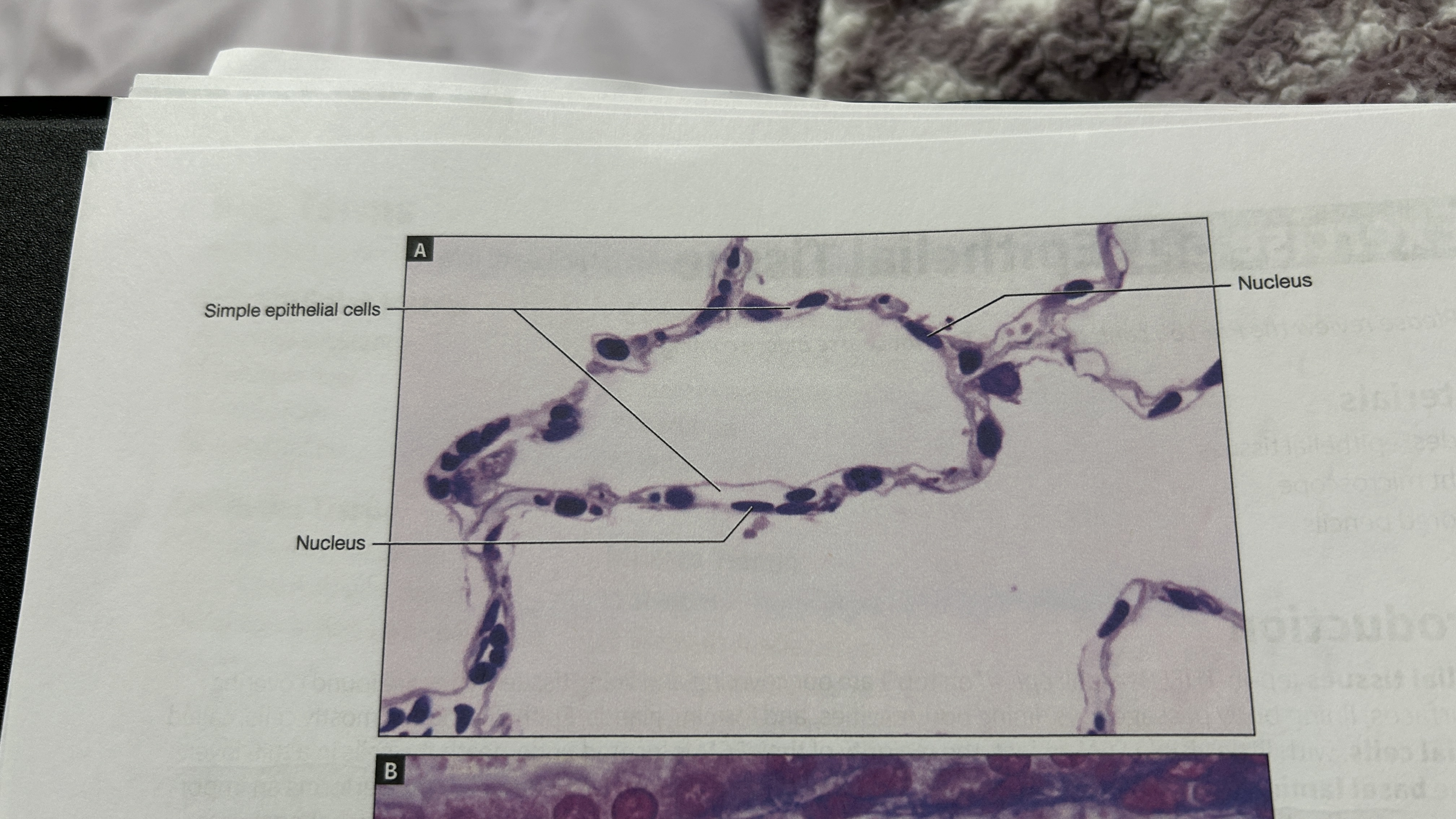 <p>Simple epithelia </p>