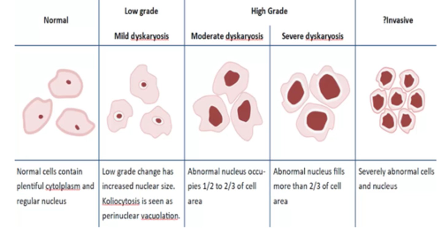 <p>LSIL (Low-grade Squamous Intraepithelial Lesion) = CIN 1; HSIL (High-grade Squamous Intraepithelial Lesion) = CIN 2 and CIN 3.</p>
