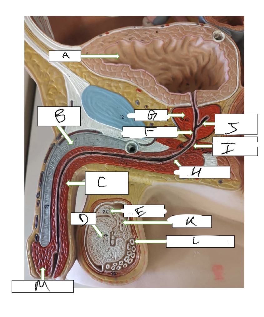 <p>What is structure L</p>
