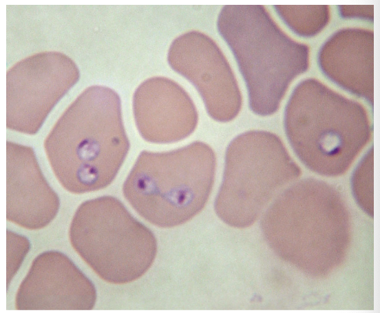 <p>what coccidia sp is this picture associated with?</p>