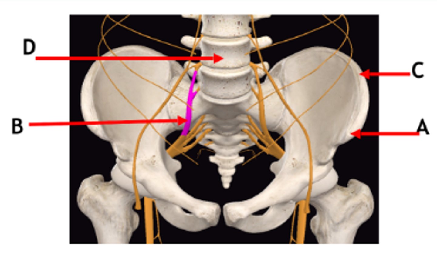 <p>A = Anterior superior iliac spine</p><p>B = Lumbosacral trunk</p><p>C = Iliac crest</p><p>D = Lumbar vertebra</p>