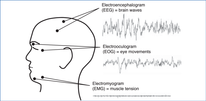 <ul><li><p><strong>Electroencephalogram (EEG)</strong> → electrodes placed on scalp, measures brain activity</p></li><li><p><strong>Electromyogram (EMG)</strong> → electrodes placed on chin, measures muscle activity</p></li><li><p><strong>Electro-oculogram (EOG)</strong> → electrodes placed near eyes, measures eye movements</p></li></ul><p></p>