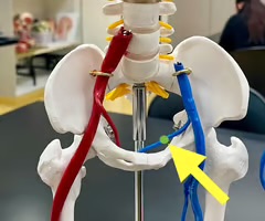 <p>Name the blood vessel.</p>