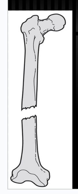 <p><span>what type of fracture completeness is this?</span></p>