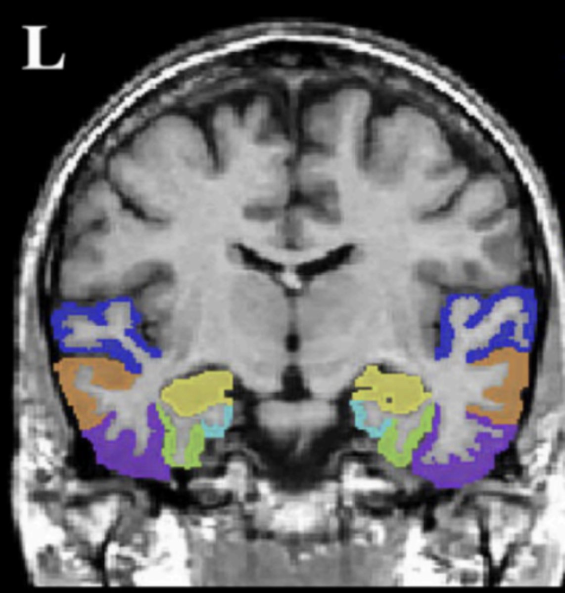 <p>dark blue area</p>