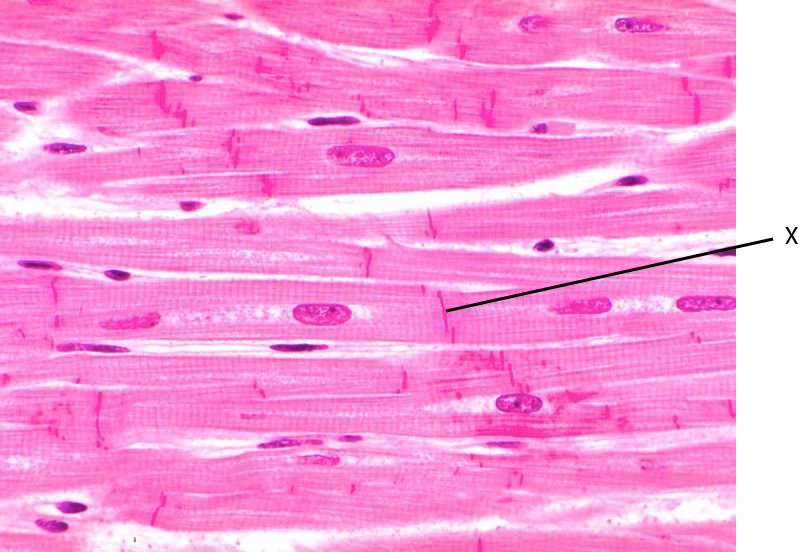 <p>What is the name of the structure in the image below</p>
