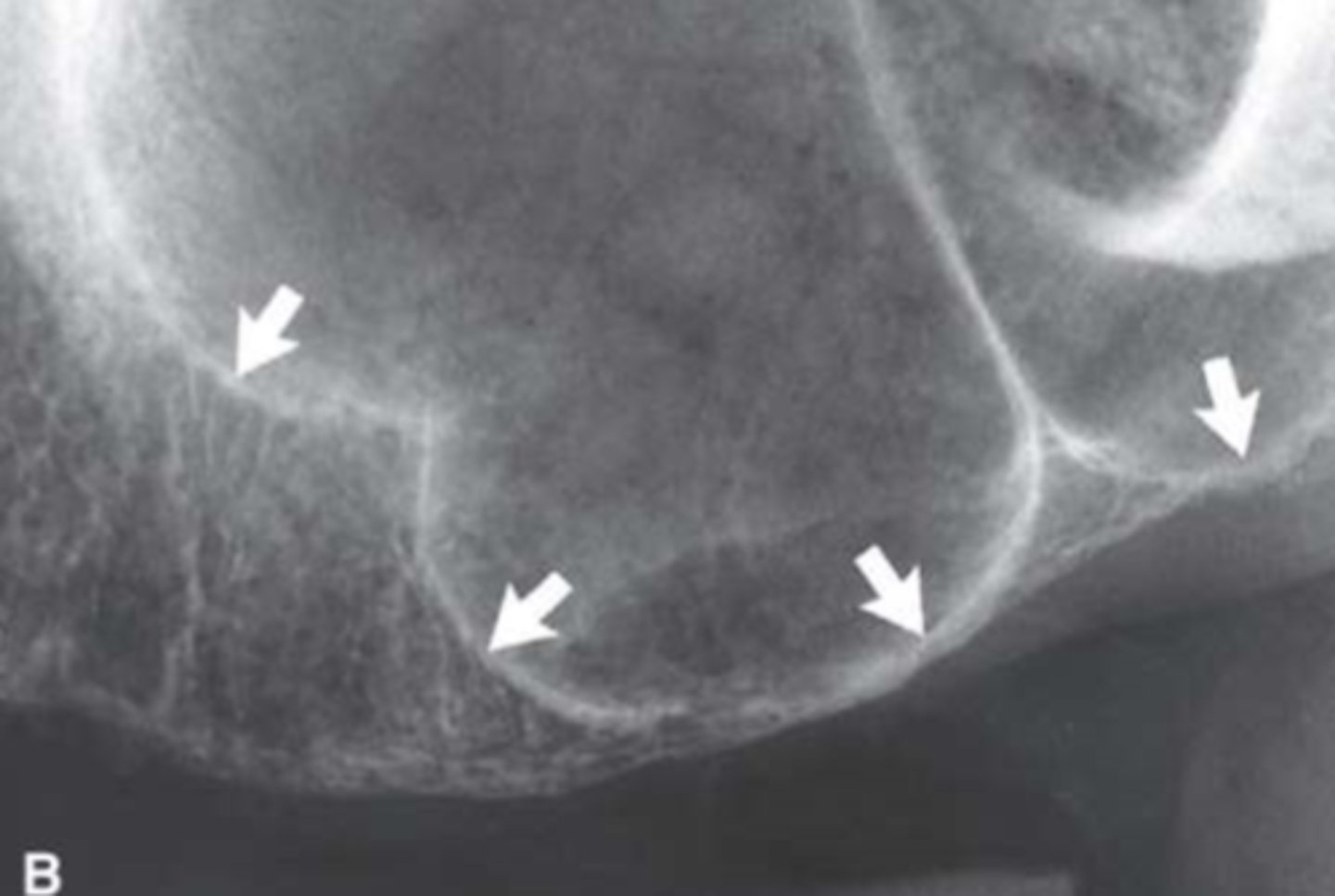 <p>Identify the structure</p>