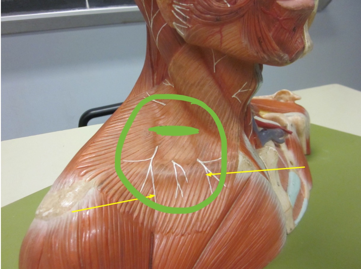 <p>What muscle is this</p>