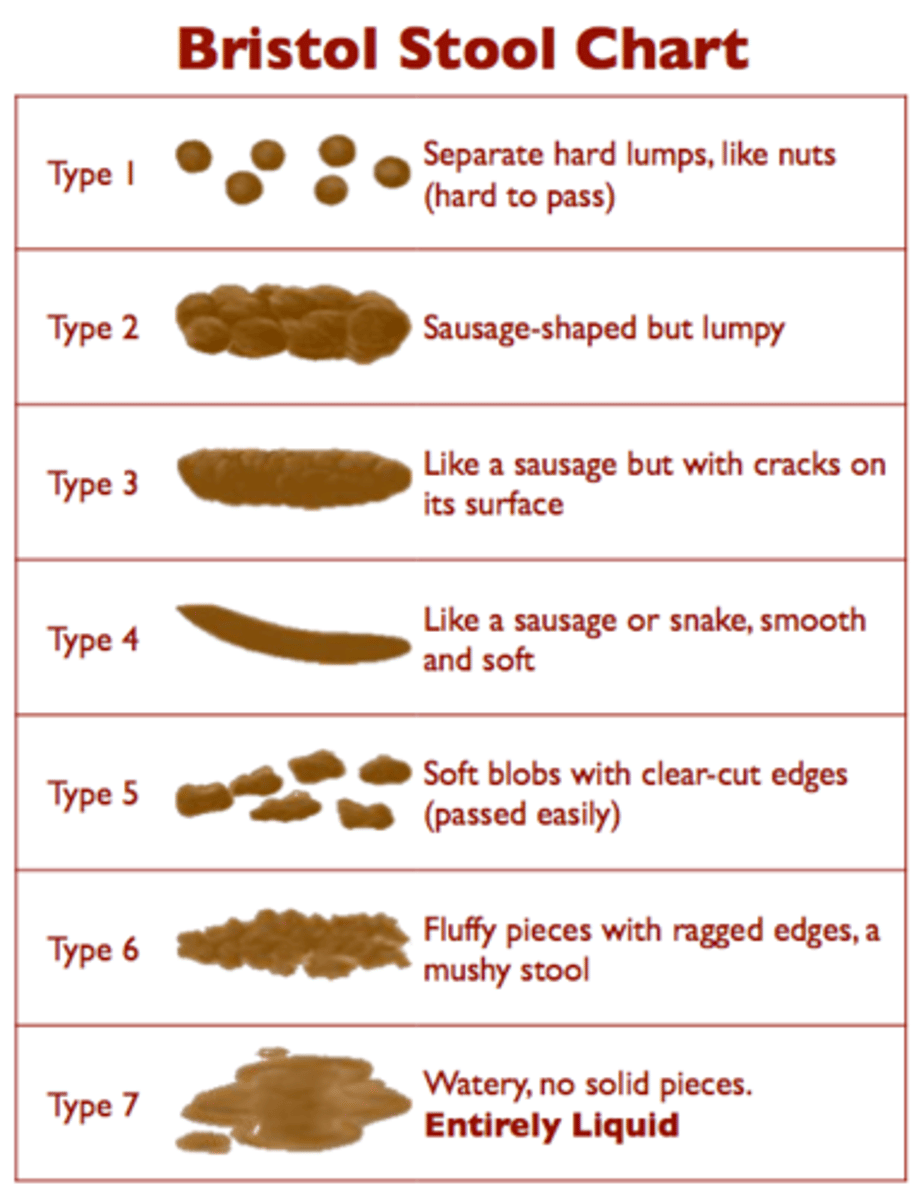 <p>Medical aid to classify stool</p><p>types 1/2: constipation</p><p>types 3/4: ideal</p><p>types 5-7: diarrhea</p>