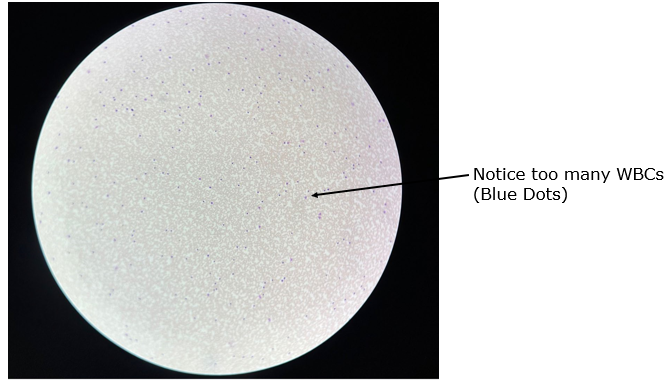 <p>What type of blood slide is this?</p>