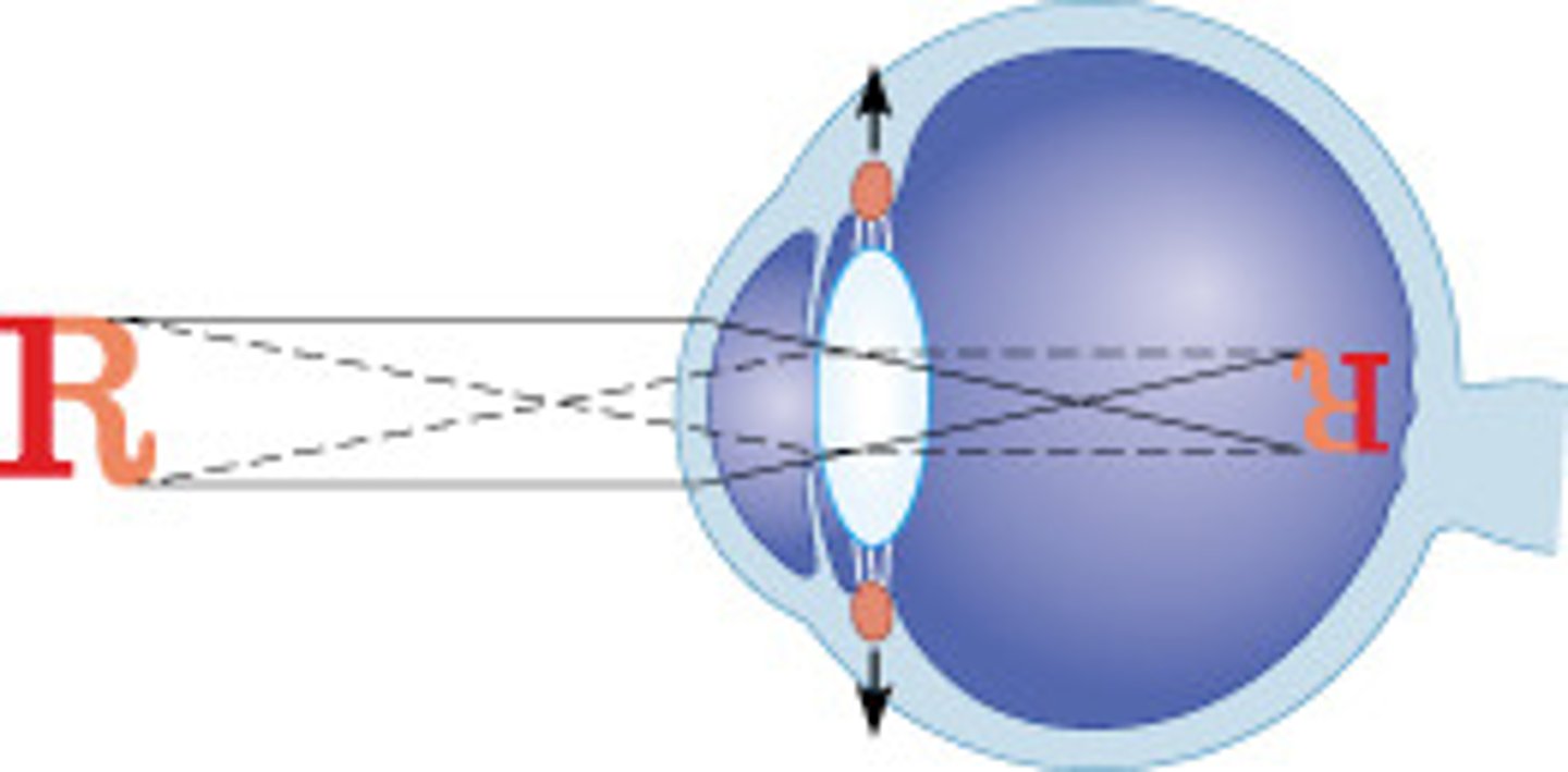 <p>contract the ciliary body</p>