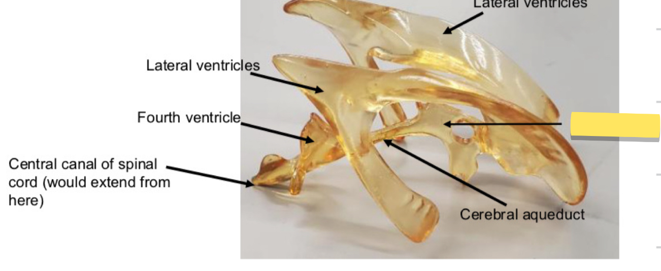<p>Name this brain ventricle</p>
