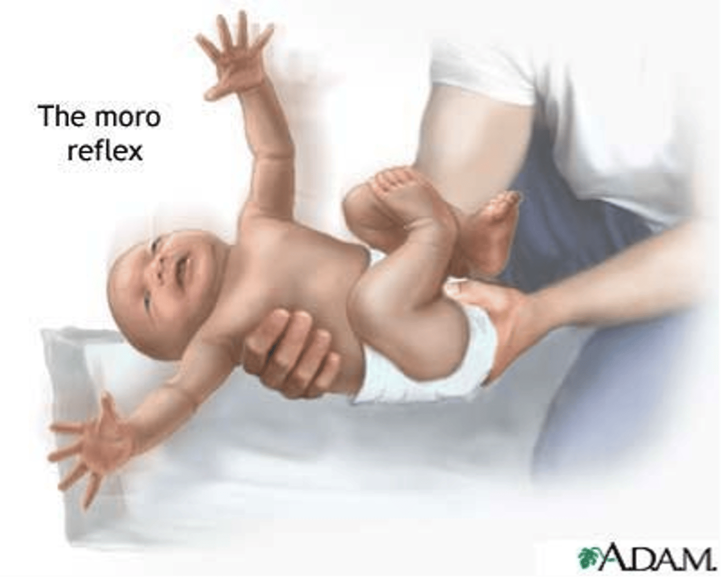 <p>extends arms, response to falling sensation</p>