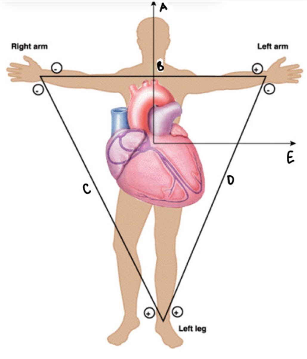 <p>label the diagram</p>