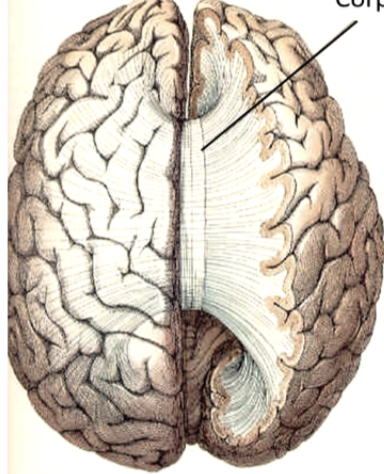 <p><span style="background-color: transparent;"><span>joins the two cerebral hemispheres together; bundles of fibers and white matter</span></span></p>