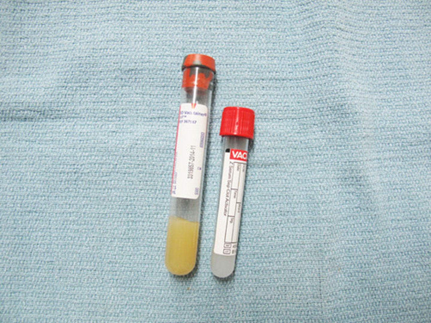 <p>Allows blood to clot</p>